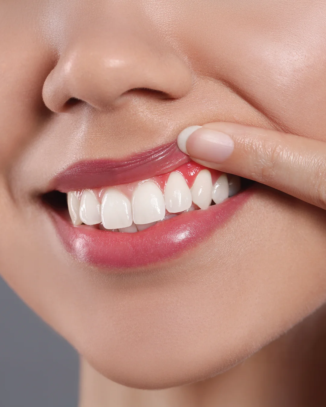 Oral Care